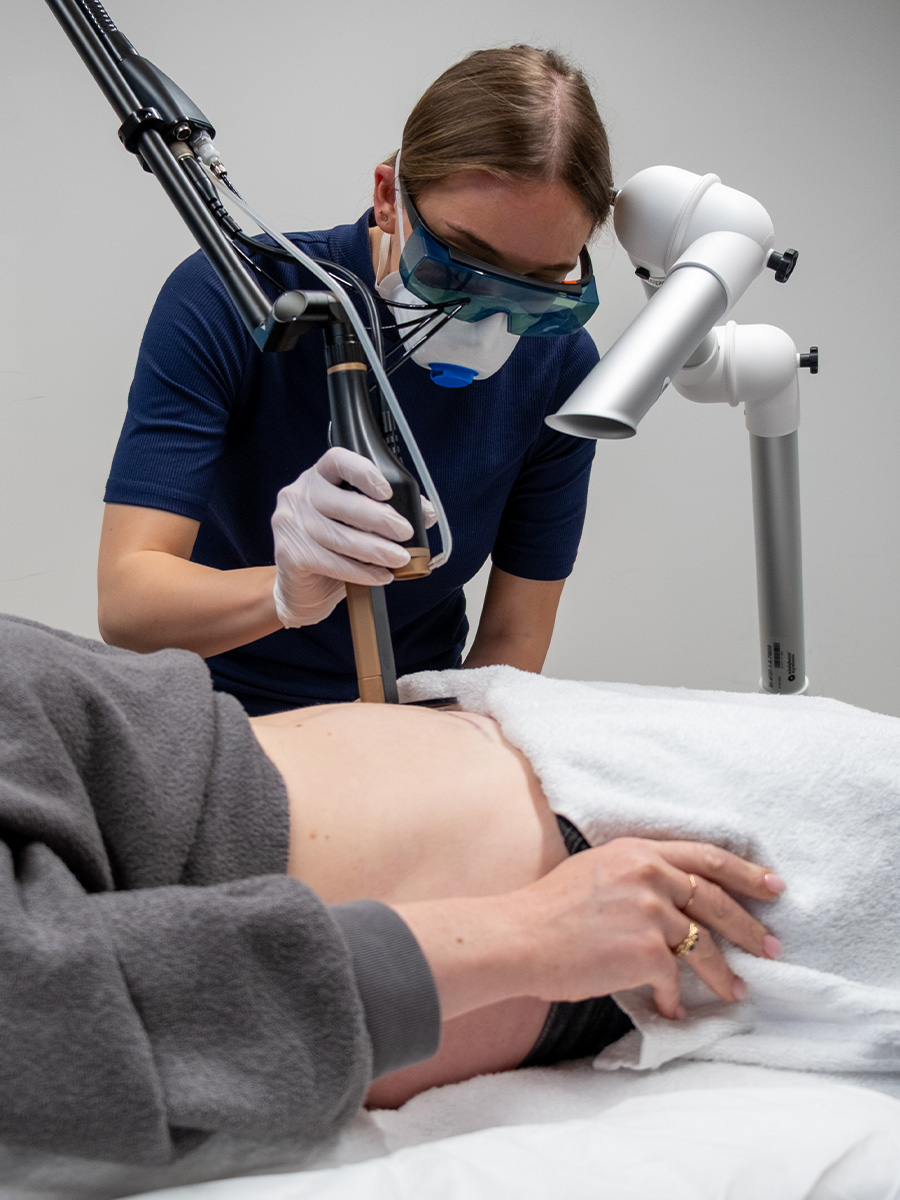 littekens verminderen in maastricht